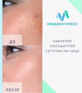 Фотография МедЭкспресс 3