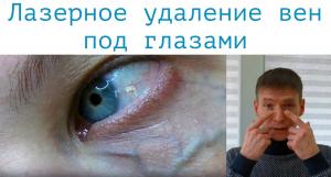 Фотография Инновационный Сосудистый Центр СПБ 5